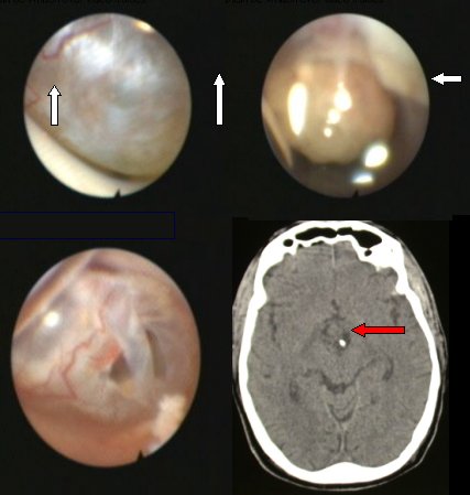 fig5-43b.jpg